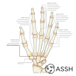 Joints-Thumb-Basal
